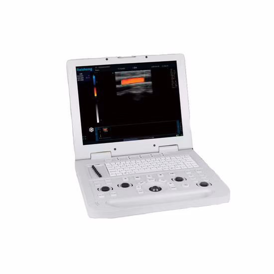 Hot Selling Portable B Mode Ultrasound Scanner Full Digital B Mode Ultrasonic Diagnostics Instruments Ultrasound Machine