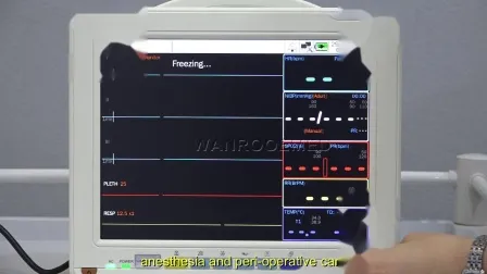 Etco2 마취 의료 CE 다중 매개변수 집중 환자 모니터